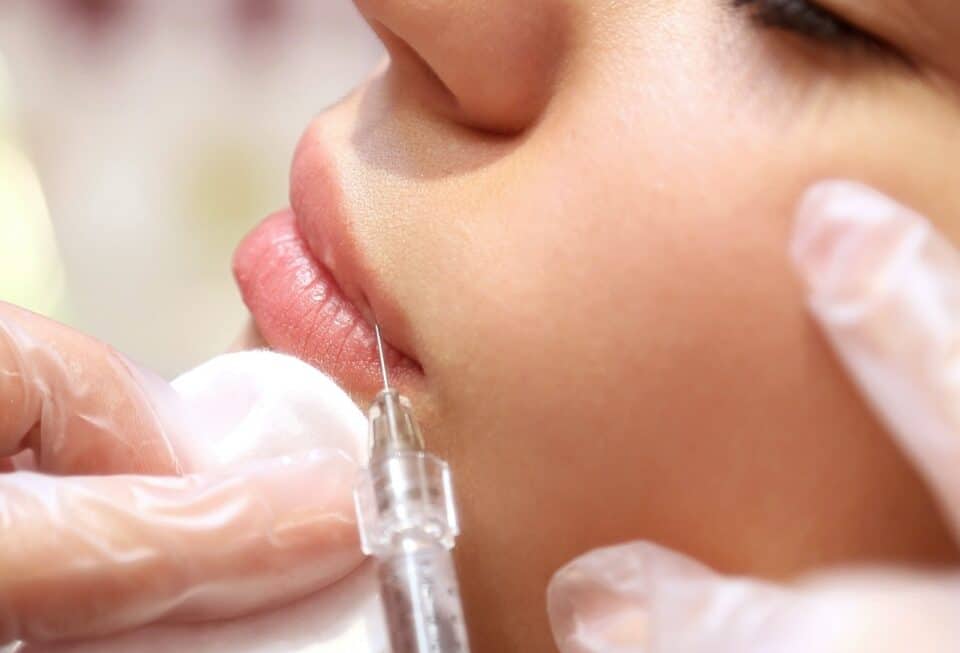 dermal filler