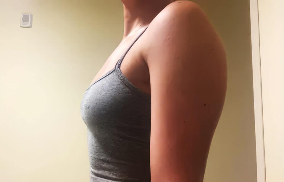 b cup breast example